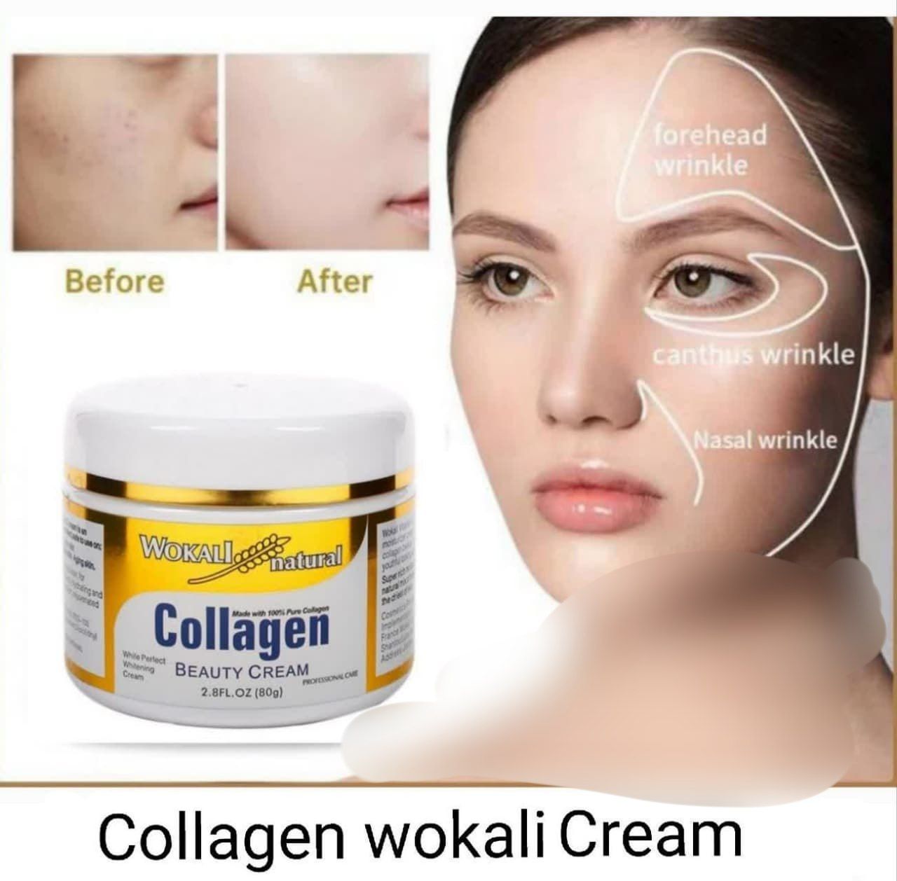 آبرسان کلاژن ووکالی